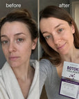 Kormesic Botoks Collagen veido serumas-ampulės nuo raukšlių – 10 × 1,5 ml