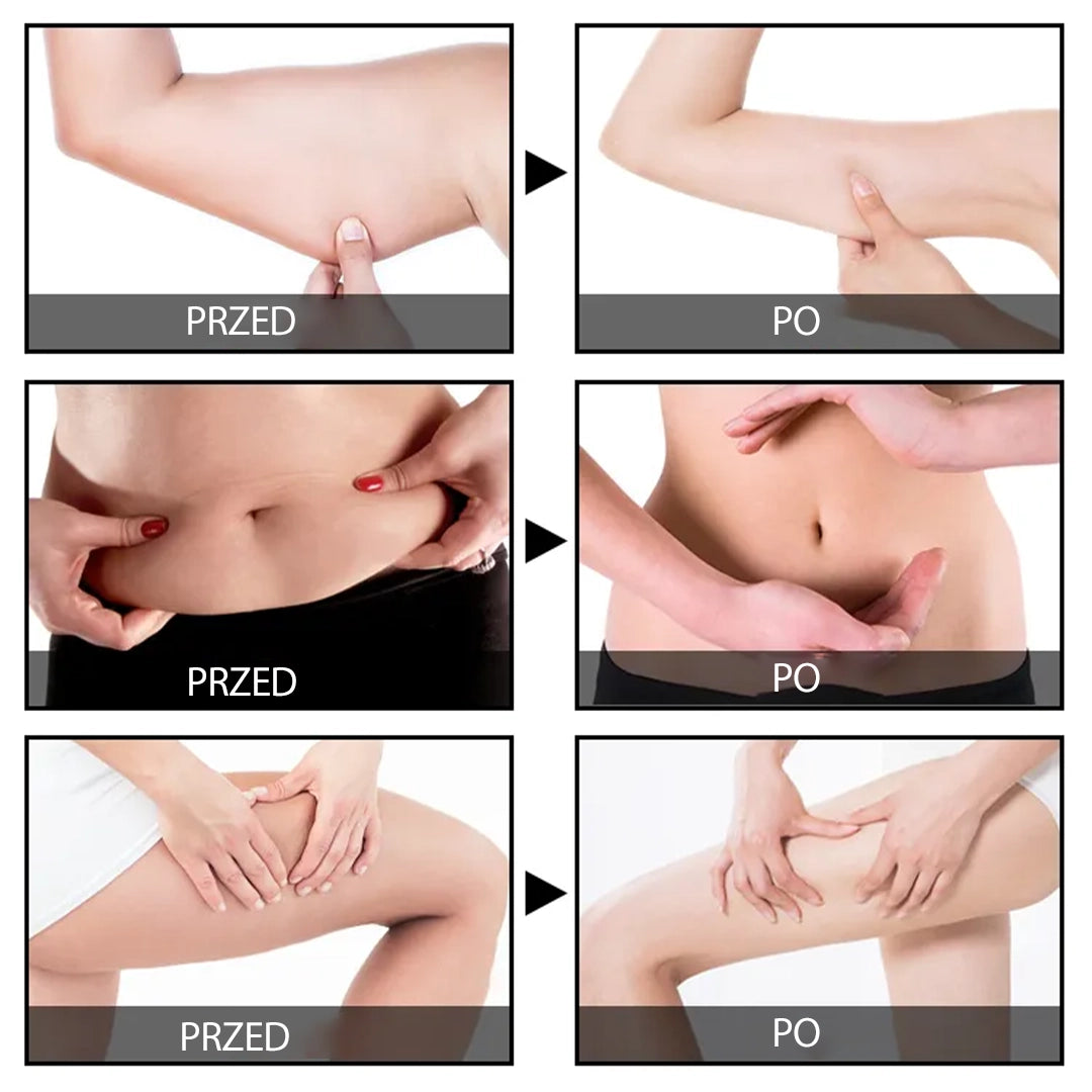 Żel wyszczuplający – modelowanie sylwetki i redukcja centymetrów!