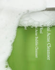 Sejas attīrošās putas Celimax The Real Noni Acne Bubble Cleanser – 155 ml