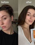 Mercilen 377 VC 577 two-phase facial oil mask – for dark spots, wrinkles, and loss of radiance, 5 pcs.