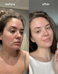 Dr.Melaxin Peel Shot PS-i kooriv näoseerum kojiinhappe ja kurkumiga, 80 ml