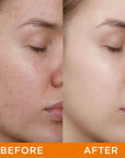 Mercilen 377 VC 577 two-phase facial oil mask – for dark spots, wrinkles, and loss of radiance, 5 pcs.
