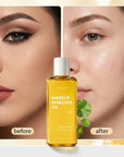 Kormesic Centella Asiatica Makeup Removal Oil – Cleansing Without Greasy Residue, 160 ml