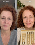 Kormesic Snails & Collagen 5-in-1 Face Care Set – Anti-Wrinkle, Moisturizing, and Firming