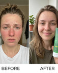 Żel po opalaniu Kormesic Aloe Vera – szybkie ukojenie, nawilżenie i regeneracja skóry po słońcu, 150 ml
