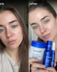 Zestaw do zwężania i oczyszczania porów Medicube 3w1 – płatki 70 szt. + ampułka 30 ml + serum 13 ml - Zestawy do twarzy