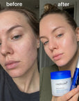 Zestaw do zwężania i oczyszczania porów Medicube 3w1 – płatki 70 szt. + ampułka 30 ml + serum 13 ml - Zestawy do twarzy