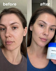 Zestaw do zwężania i oczyszczania porów Medicube 3w1 – płatki 70 szt. + ampułka 30 ml + serum 13 ml - Zestawy do twarzy