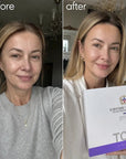 5 viename veido priežiūros rinkinys „TOEO 377+577“ – glotnina raukšles, suvienodina odos atspalvį ir suteikia spindesio