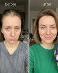 Kopfhautlösung Kormesic 5% Minoxidil – unterstützt Haarwachstum und Haardichte