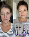 Zestaw do pielęgnacji twarzy Kormesic Botox Collagen 5D – przeciwzmarszczkowa pielęgnacja, 5 produktów