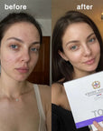 5 viename veido priežiūros rinkinys „TOEO 377+577“ – glotnina raukšles, suvienodina odos atspalvį ir suteikia spindesio