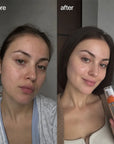 Pianka do mycia twarzy Mercilen 377 VC 577 – rozjaśnienie przebarwień i głębokie oczyszczenie, 150 ml