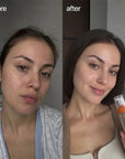 Pianka do mycia twarzy Mercilen 377 VC 577 – rozjaśnienie przebarwień i głębokie oczyszczenie, 150 ml