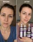 Zestaw do pielęgnacji twarzy Kormesic Botox Collagen 5D – przeciwzmarszczkowa pielęgnacja, 5 produktów