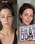 Zestaw do pielęgnacji twarzy Kormesic Botox Collagen 5D – przeciwzmarszczkowa pielęgnacja, 5 produktów