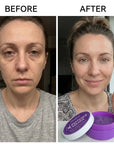 Zestaw pod oczy Kormesic – płatki pod oczy Botoks Keratin 60 szt. + stick pod oczy Botoks Collagen 5 g