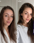 Kopfhautlösung Kormesic 5% Minoxidil – unterstützt Haarwachstum und Haardichte