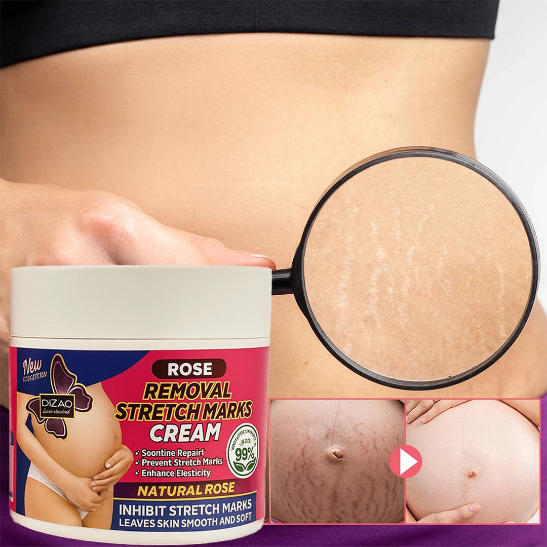 Krem na rozstępy z różą – łagodzący, regenerujący, nawilżający