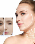 Kolagenowe Nici HIH 4D Lift | Zestaw 8 słoiczków + GRATIS LOTION BOTОX COLLAGEN 120 ML