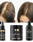 Zestaw przeciw wypadaniu włosów z minoksydylem 5% Kormesic (szampon + maska + serum)