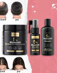 Zestaw przeciw wypadaniu włosów z minoksydylem 5% Kormesic (szampon + maska + serum)