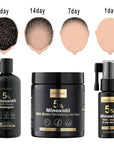 Zestaw przeciw wypadaniu włosów z minoksydylem 5% Kormesic (szampon + maska + serum)