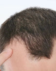Zestaw przeciw wypadaniu włosów z minoksydylem 5% Kormesic (szampon + maska + serum)