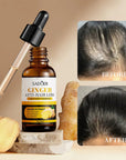 Galvos odos serumas nuo plaukų slinkimo su imbieru – Ginger Anti-Hair Loss, 30 ml