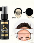 Serum z 5% Minoksydylem i Biotyną – intensywna kuracja przeciw wypadaniu włosów