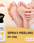 Spray-Peeling do stóp