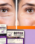 Zestaw do pielęgnacji skóry KORMESIC Botox Collagen