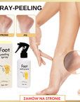 Spray-Peeling do stóp