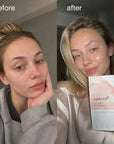 Maska liftingująca do twarzy Medicube Collagen Lifting Mask – kolagen, jędrność i glass skin, 27 g