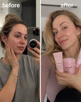 Medicube PDRN Pink Gesichtspflegeset – Pads, Augencreme und Nachtmaske