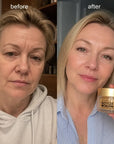 Serum do twarzy w kapsułkach z jadem pszczelim Kormesic Botox Bee Venom – 30 kapsułek