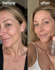 Serum pod oczy w kapsułkach SADOER Retinol – kolagen i niacynamid, 45 kapsułek - Serumy pod oczy