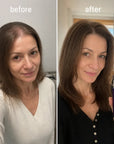 Serum przeciw wypadaniu włosów Kormesic 5% Minoxidil – wzrost i większa gęstość 30 ml