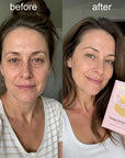 Płatki pod oczy Grace & Stella Collagen Gel Eye Mask – cienie, opuchlizna i zmarszczki, 6 par - Płatki pod oczy