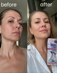 Maska na szyję Kormesic Neck Mask Skin Care – nawilżająca, wygładzająca i ujędrniająca - Maski do szyi