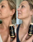 Sztyft do szyi z jadem pszczelim Kormesic Bee Venom Anti-Wrinkle Neck Stick 30 g