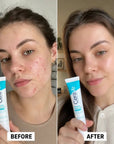 Cerave gel Control Imperfections 40 ml