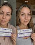 Sérum na obličej v ampulích Kormesic Botox Collagen – 7 ampulí