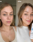 Tonik-mgiełka do twarzy z kwasem hialuronowym Kormesic HA Firming Emulsion – 120 ml