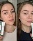Krem punktowy na wypryski Skin1004 Tea-Trica Spot Cream 20 ml