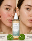 SKIN1004 - Madagascar Centella Teca Soothing Toner - Intensywnie Łagodzący Toner - 210ml - Tonery do twarzy
