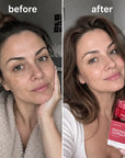 Krem do twarzy Kormesic Niacinamide TXA Capsule Cream – rozjaśnienie, nawilżenie i wyrównanie kolorytu skóry 70 g