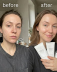 Rozjasňující sada na obličej SKIN1004 Tone Brightening – gel, sérum a krém