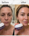Krem kapsułkowy do twarzy Kormesic Botoks Collagen – wygładzenie, nawilżenie i efekt jędrniejszej skóry - Kremy do twarzy