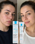 La Roche-Posay Effaclar Krem o potrójnym działaniu